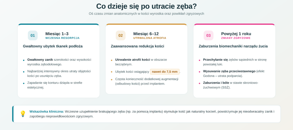"Co dzieje się po utracie zęba?" – etapy zaniku kości: miesiąc 1–3 wczesna resorpcja, miesiąc 6–12 utrwalona atrofia (ubytek kości do 7,5 mm), powyżej 1 roku zmiany zgryzowe; wskazówka kliniczna: wczesne uzupełnienie zęba implantem hamuje zanik kości